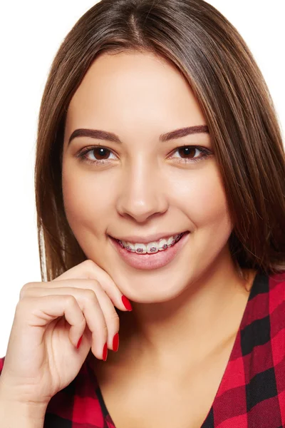 Adolescente hembra sonriendo con frenillos en los dientes —  Fotos de Stock