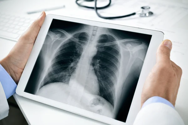 Médico observando uma radiografia de tórax em um comprimido — Fotografia de Stock