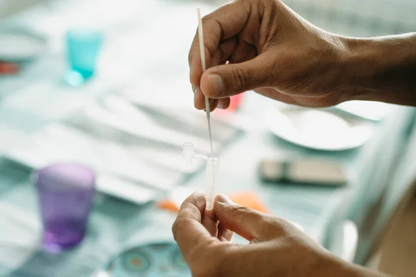 Young Caucasian Man Places Nasopharyngeal Swab His Own Sample Pipette — Stock Photo, Image