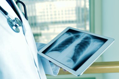doctor observing a chest radiograph in a tablet clipart