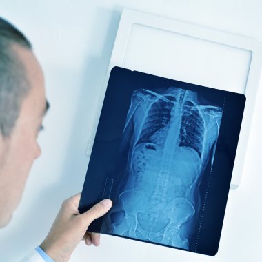 doctor observing a skeleton radiograph clipart