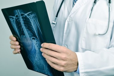 bir iskelet grafisi gözlemleyerek doktor