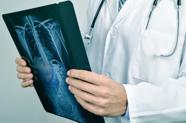 doctor observing a skeleton radiograph clipart