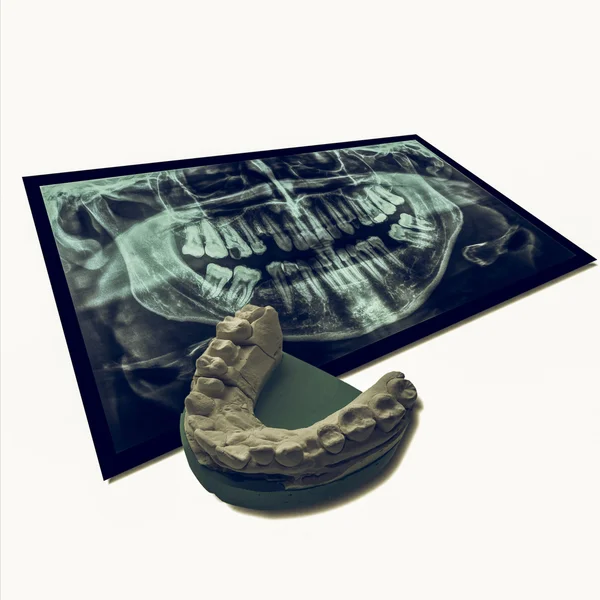 Вінтажний погляд Рентген зубів з позитивними зубами відлиті — стокове фото