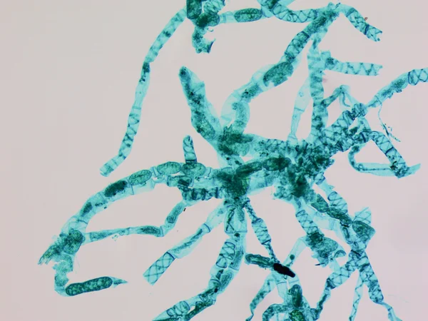 Spirogyra test — Stok fotoğraf