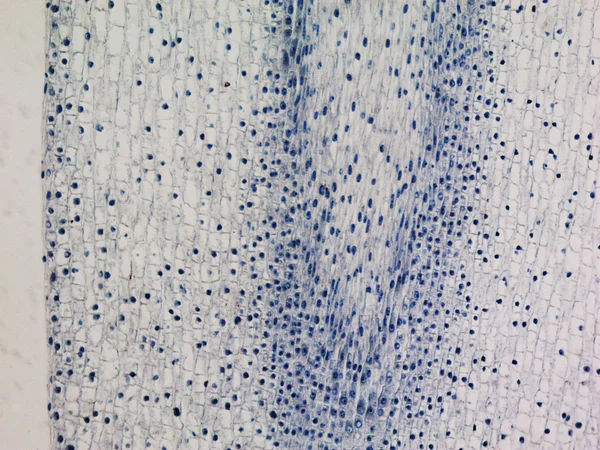 Micrografia de ponta de raiz de milho — Fotografia de Stock