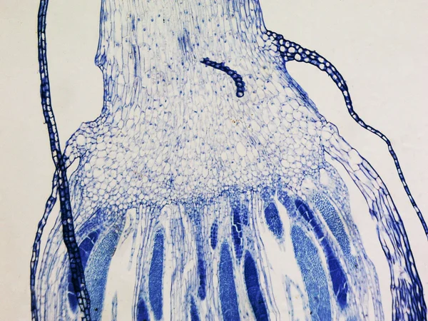 Micrographie de protonemata de mousse — Photo