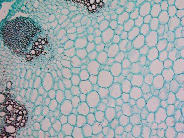 Heliansthus stem micrograph clipart