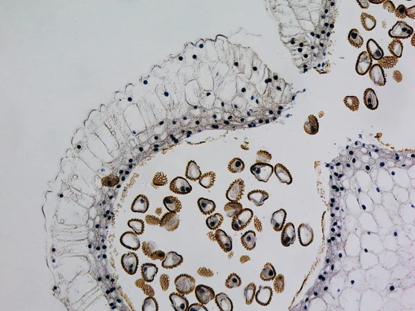 Micrographie de l'anthère Lily — Photo