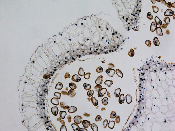 Lily anther micrograph