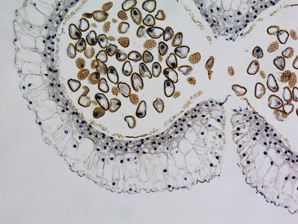 Lily anther micrograph