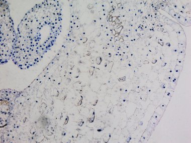 Lily yumurtalık test