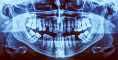 Retro görünüm tıbbi Xray