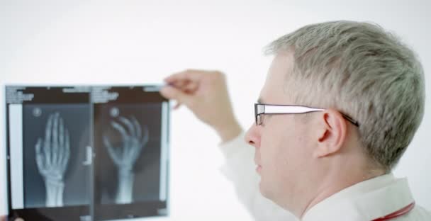 Man arts onderzoekt arm x-ray schot op een filmkijker — Stockvideo