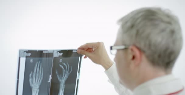 Läkare tittar på arm röntgen skott på en film viewer — Stockvideo