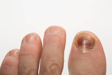 Büyük miktarda bilgi depolamak için bilgisayar sabit diski