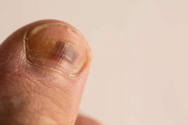 Disco Duro Del Ordenador Para Almacenar Grandes Cantidades Información — Foto de Stock