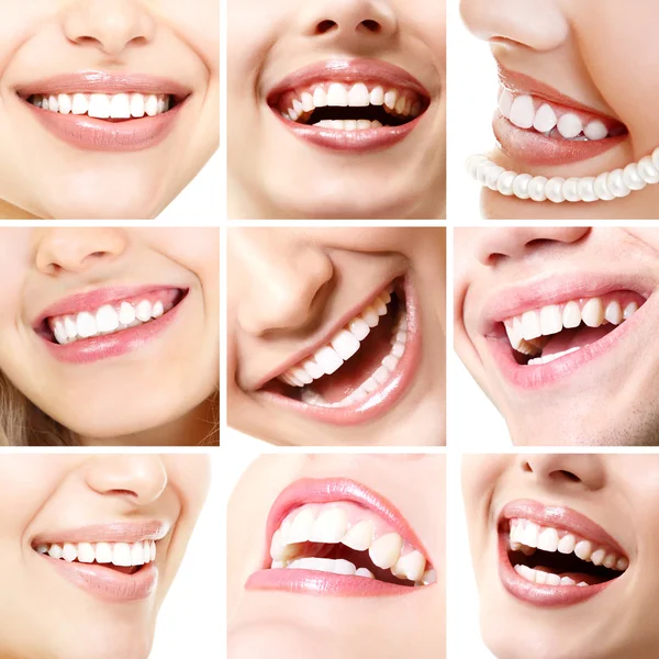 Sonrisas perfectas . — Foto de Stock