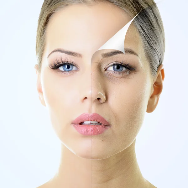 Woman with problem and clean skin — Stock Photo, Image