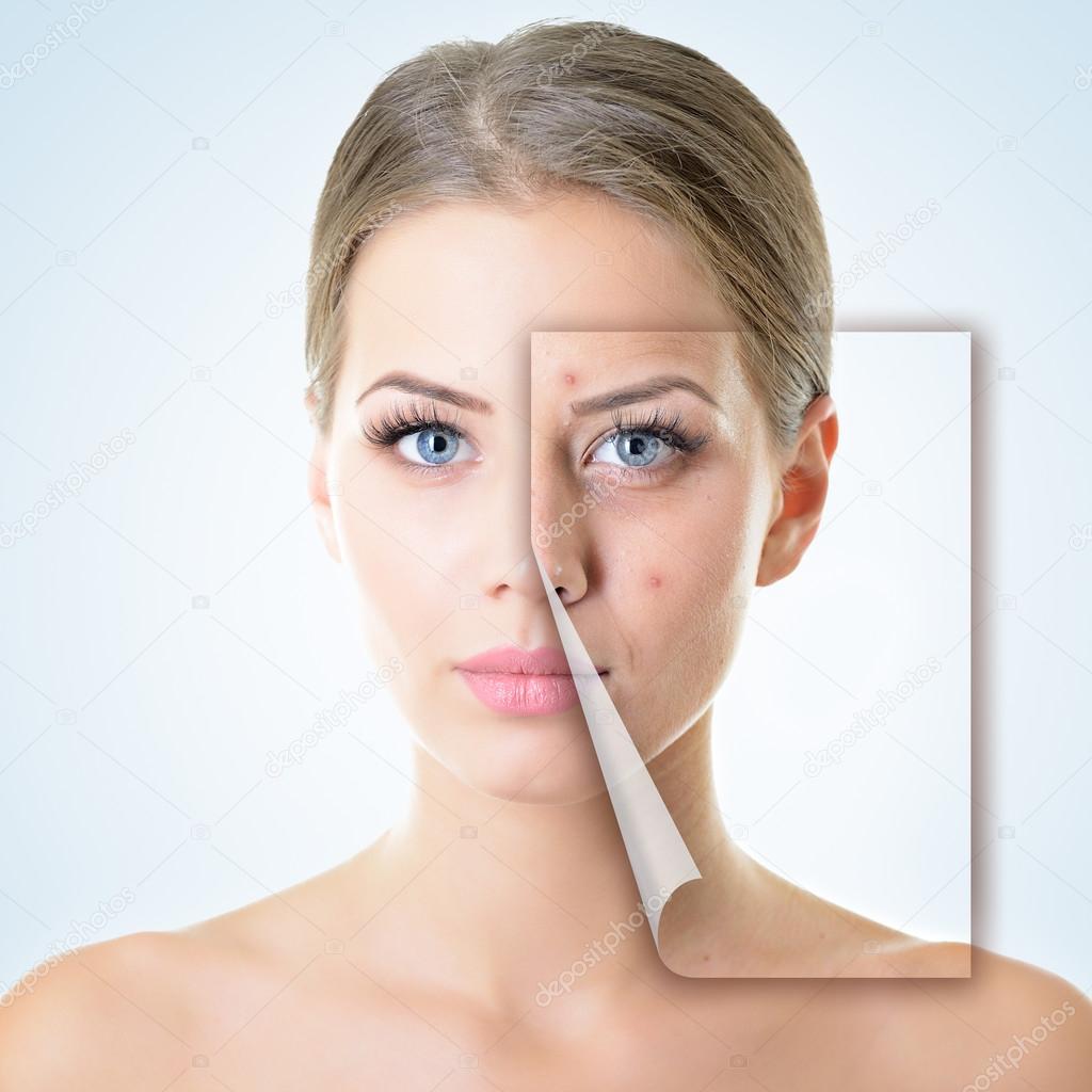 woman with problem and clean skin