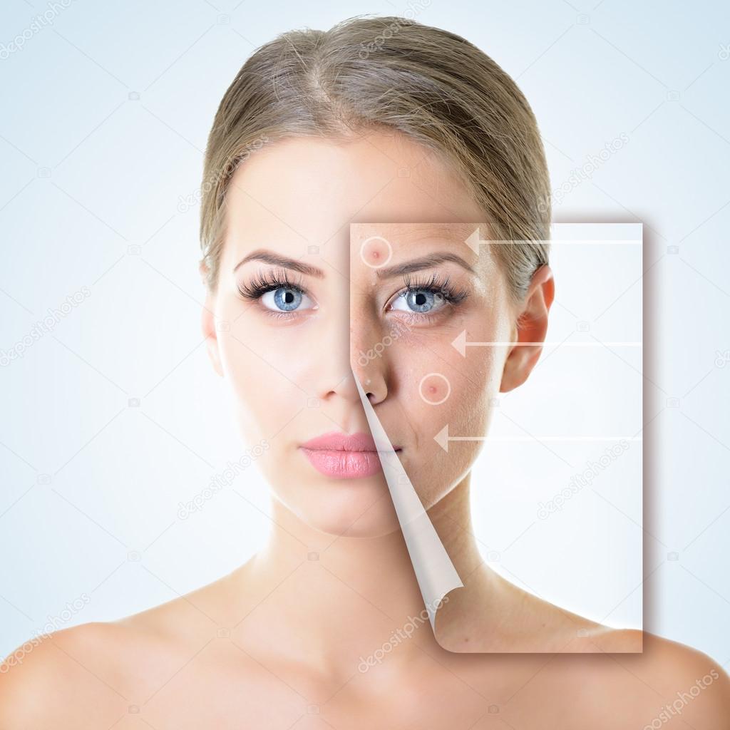 woman with problem and clean skin