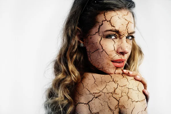 Cracked skin — Stock Photo, Image