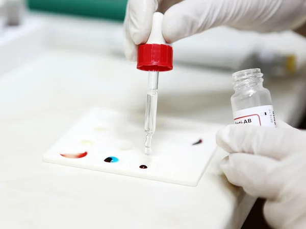 血液测试-彩色图像 — 图库照片
