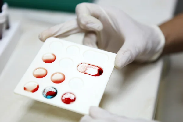 血液测试-彩色图像 — 图库照片