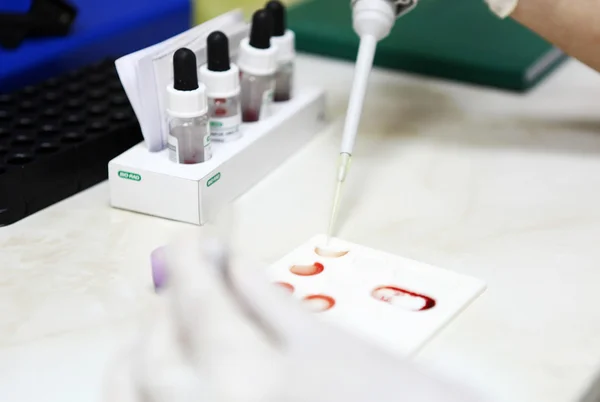 血液検査 - カラー画像 — ストック写真