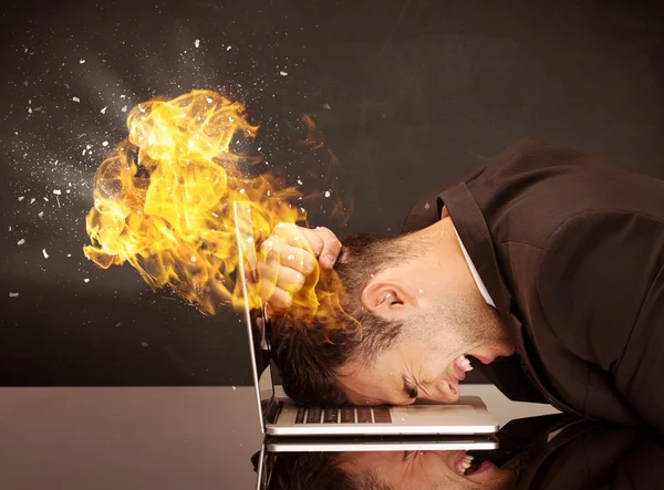 Stressed business man's head is burning — Stock Photo, Image