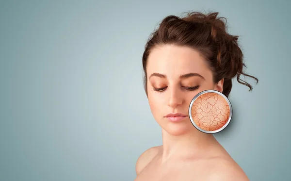 Beautiful young girl with magnifying glass of skin damage — Stock Photo, Image