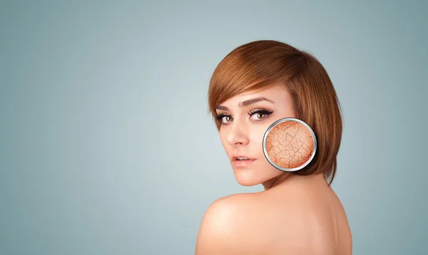 Beautiful young girl with magnifying glass of skin damage — Stock Photo, Image