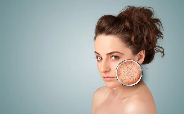 Beautiful young girl with magnifying glass of skin damage — Stock Photo, Image