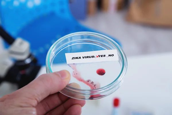 Bloedmonster positieve met Zika-virus — Stockfoto