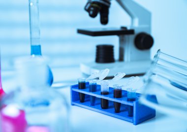 dna 분석을 위한 실험실에서 생물학 견본을 가진 마이크로 튜브