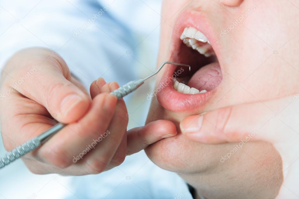 Close-up of patients open mouth during oral checkup with mirror near by