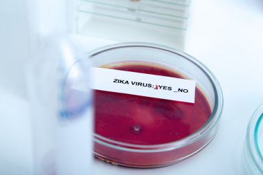 Blood sample positive with Zika virus clipart