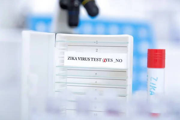 Bloedmonster positieve met Zika-virus — Stockfoto