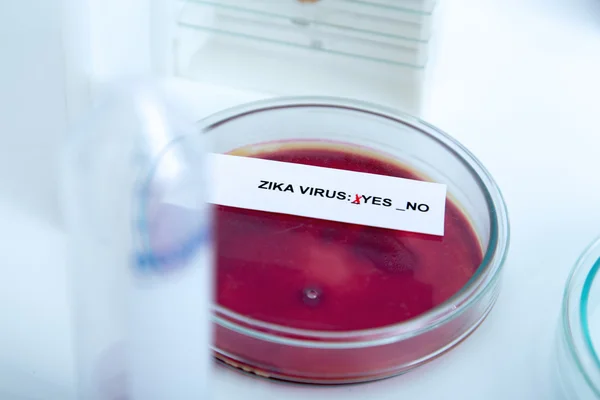 Muestra de sangre positiva con el virus del Zika — Foto de Stock