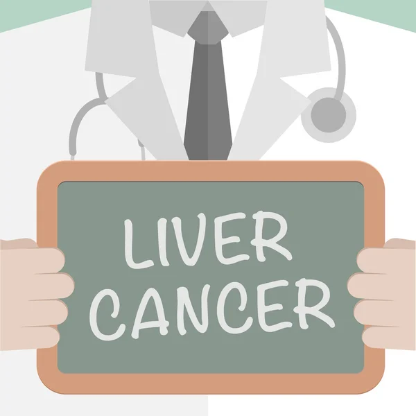 Tıp Kurulu karaciğer kanseri — Stok Vektör