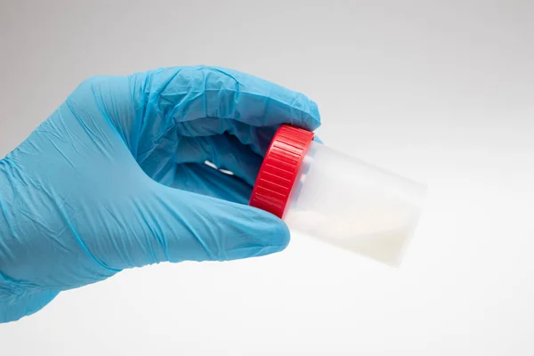 Doktor sperm analizi için plastik bir kavanoz tutuyor. Hastanede tıbbi test. Bankada sperm analizi. Örnek sperm. Donör Spermi. Erkek sağlığı kavramı.