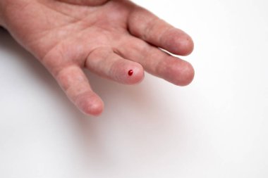 Bir adamın parmağına kan damlası şekeri test etmek için..