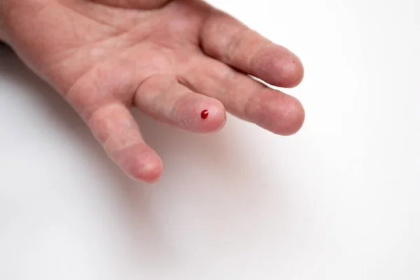 Uma Gota Sangue Dedo Homem Para Testar Açúcar Sangue — Fotografia de Stock