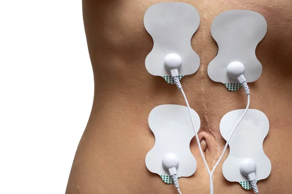 Elektrody Pro Elektrický Stimulátor Břiše Ženy Lipomassage Dívčí Tělo Lázních — Stock fotografie