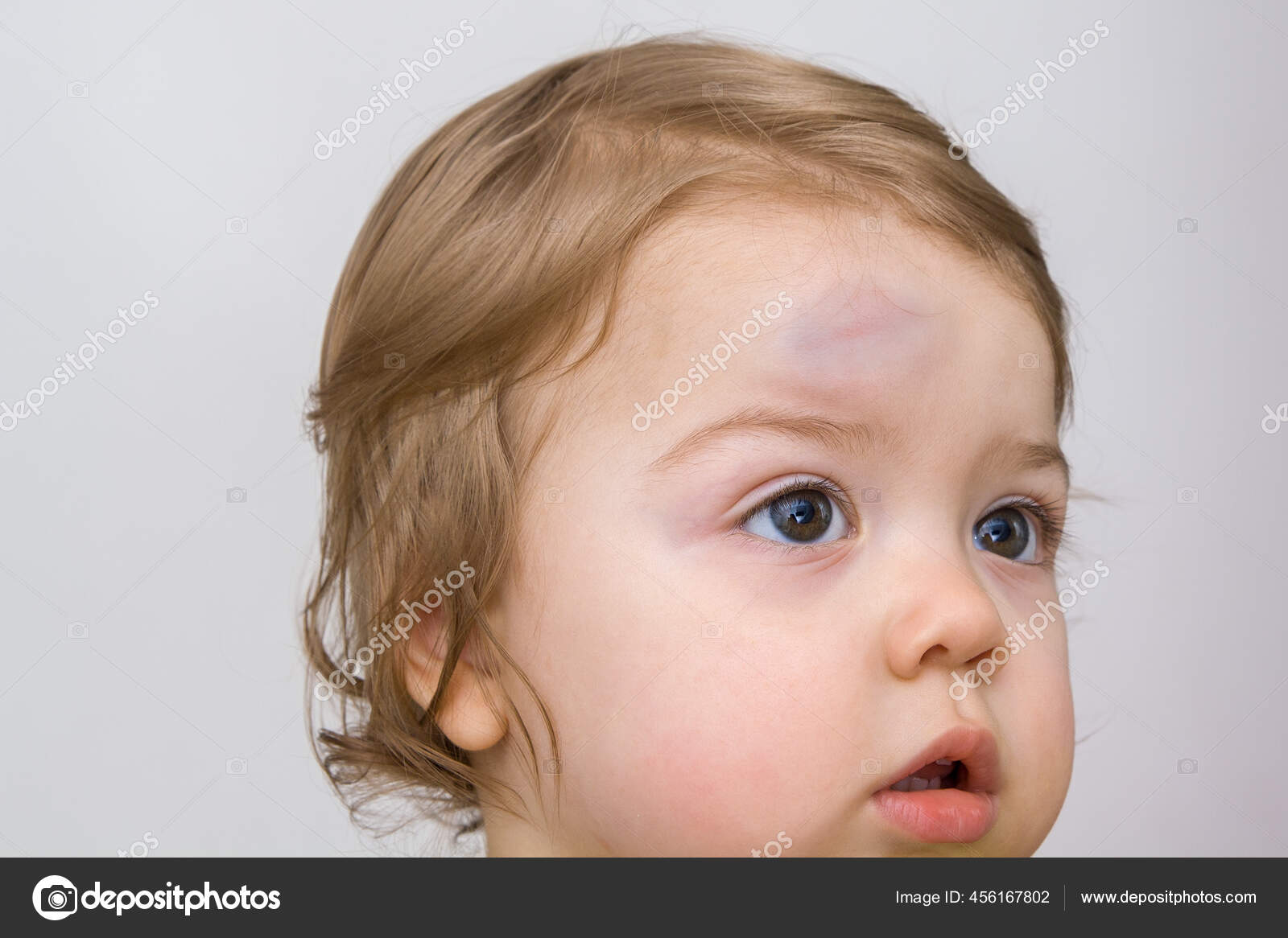 [Le plus préféré] bosse front bébé 265360Bosse front bebe 11 mois