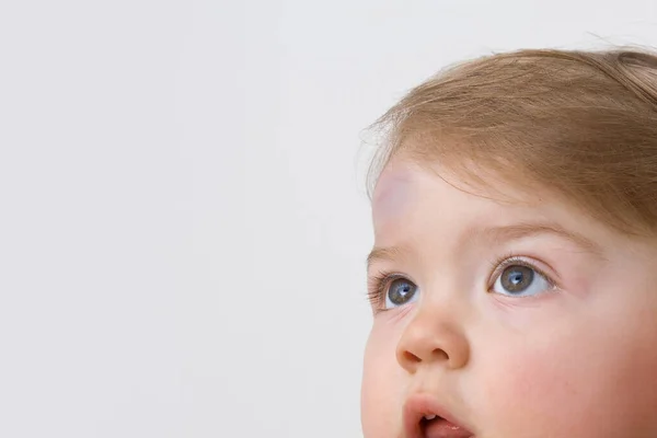 Baby Bruises Images Libres De Droit Photos De Baby Bruises Depositphotos Baby Bruises Images Libres De Droit Photos De Baby Bruises Depositphotos