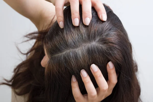 Vrouw Toont Grijs Haar Haar Hoofd Haar Met Stukjes Grijs — Stockfoto