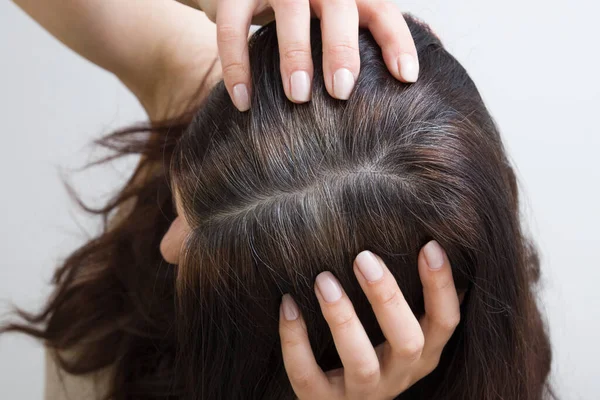 Mujer Muestra Pelo Gris Cabeza Cabello Con Fragmentos Pelo Gris — Foto de Stock