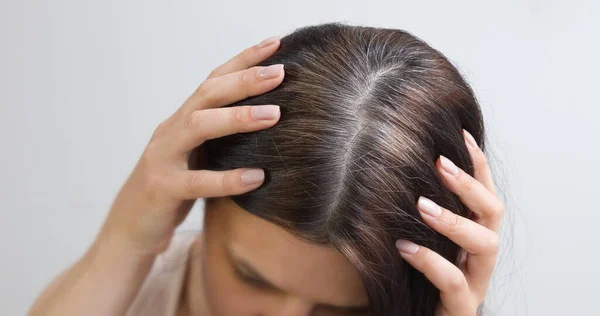 Close up are fragments of gray hair on the head of a young woman. Early gray hair concept. Gray hair color and structure — Stock Photo, Image