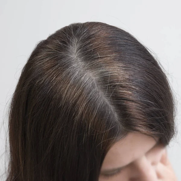 Z bliska są fragmenty siwych włosów na głowie młodej kobiety. Wczesna koncepcja siwych włosów. Siwe włosy kolor i struktura — Zdjęcie stockowe
